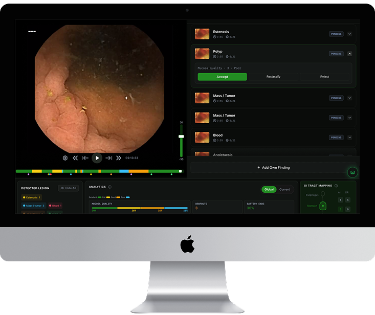 Clinical team performing capsule endoscopy